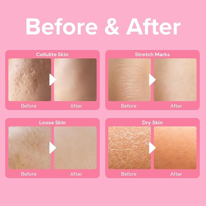Enaskin Naturals Anti Cellulite Body Firming Cream
