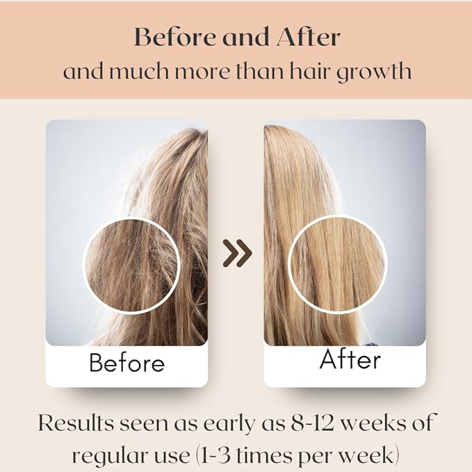 Revatology Hair Growth Oil for Adults, Ayurvedic Pre Wash and Overnight Scalp Treatment for Thinning Hair, 30 Cold Pressed Botanicals with Rosemary and Castor Oil, Made in USA