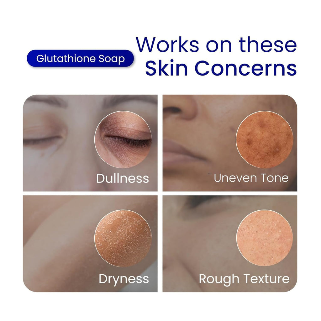 Relumins Glutathione + Kojic Acid Soap Bars Whitening and Darkspot Corrector - Deep Cleansing & Hydrating Soap for Refreshed Skin Perfect - Gentle Exfoliating Formula - 135g x 5 Bars
