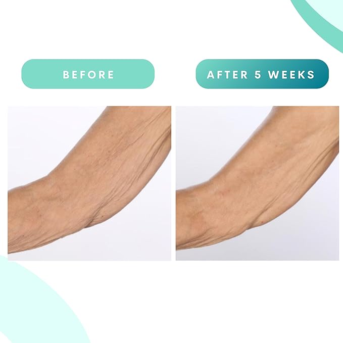 Serious Skincare, Glycolic Firming Retexturizing Body Cream with BODY FIT™, Moisturizing Lotion for Dry Skin, for Loose Crepey Skin Arms, Legs, Belly, Gentle Exfoliation for Smooth & Glowing Skin 8 Oz