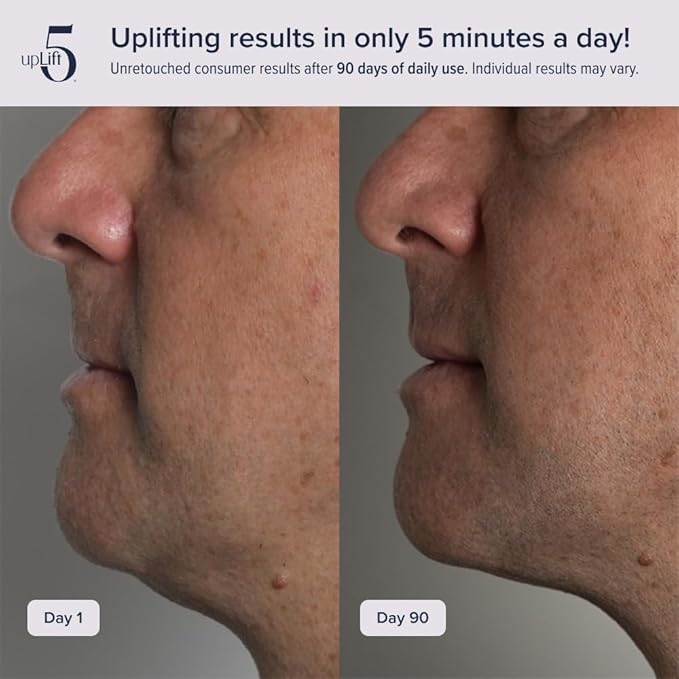 upLift 5 Anti-Aging Device | Prevent Long-Term Facial Decline