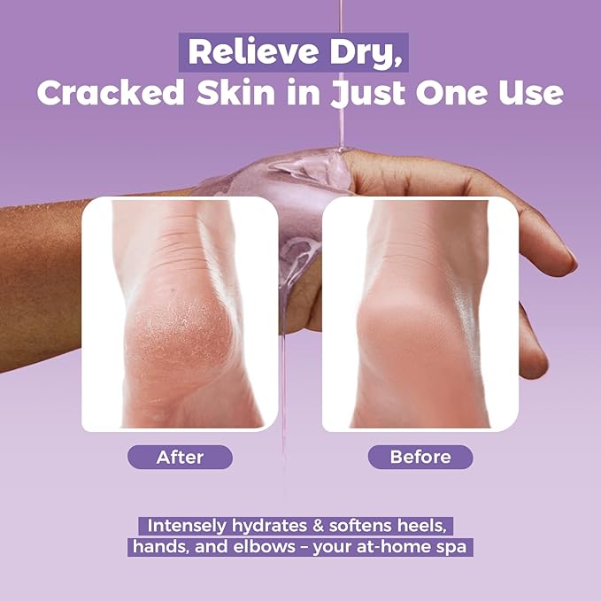 GIRLEARLE Paraffin Wax Refills 10 Packs for Paraffin Wax Bath Machine - for Dry Cracked Skin on Hands, Feet, Elbows - Moisturizing Hydration to Relieve Stiff Muscles & Joints (Lavender)