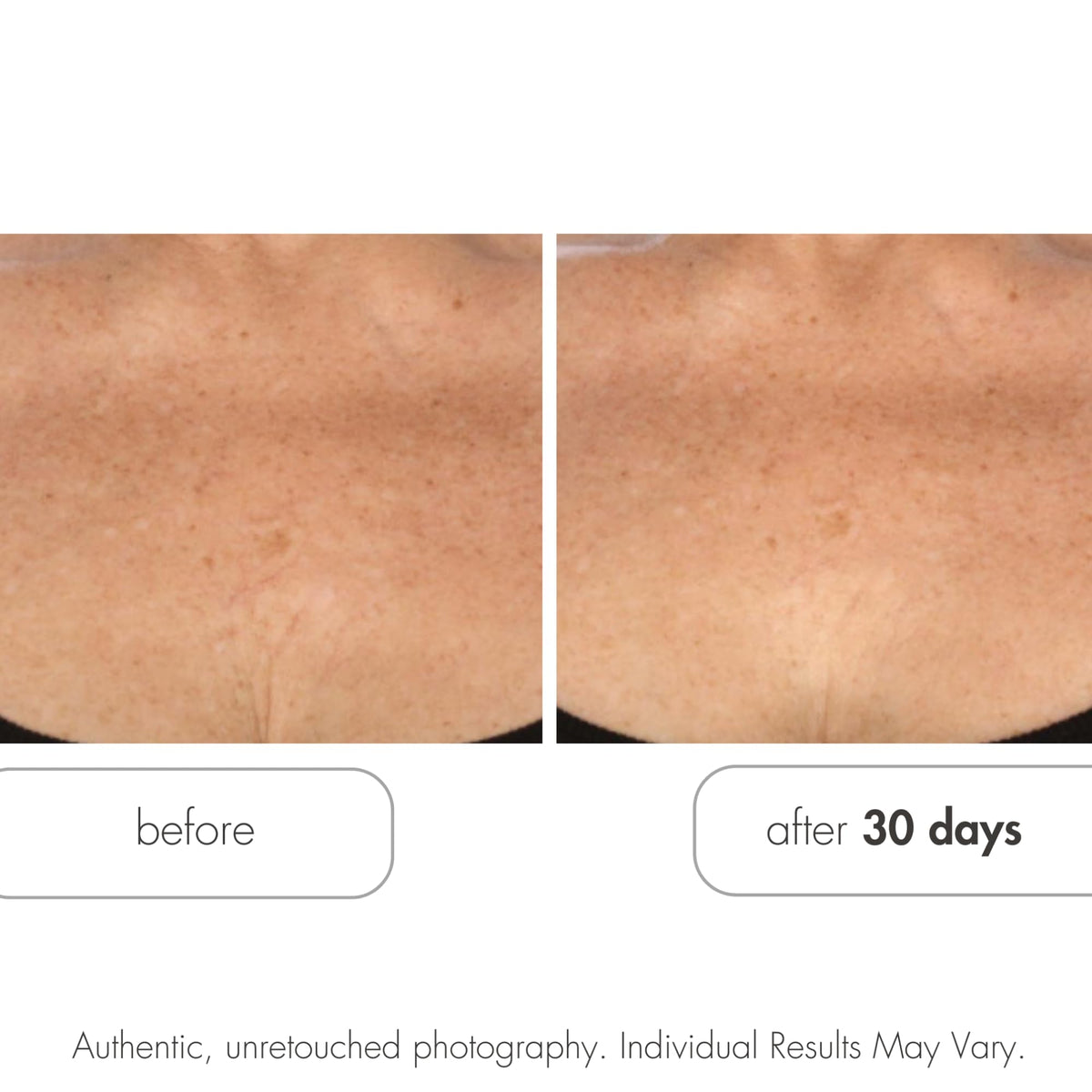 Serious Skincare Glycolic Retexturizing Toning Body Cream with BODY FIT™