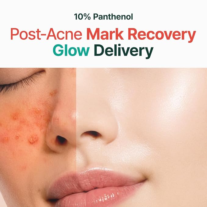 PURITO Panthenol 10% Cream | Korean Skin Barrier Repair & Glow Boost