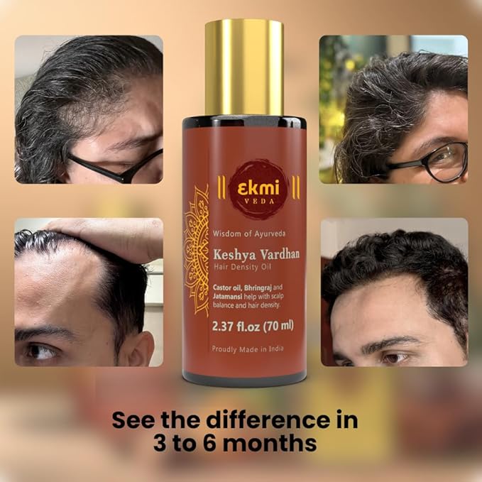 EKMIVEDA Ayurvedic Castor & Rosemary Oil For Hair Density With Bhringraj, Coconut, Amla, Argan, Brahmi. DHT Blocker. Hair Loss Treatment For Women & Men, 2.37 Fl Oz