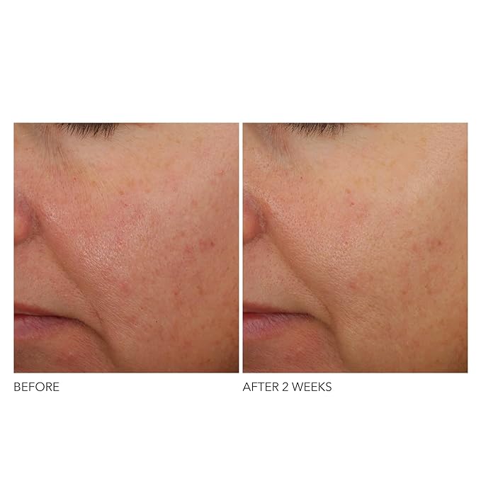 Dr Dennis Gross Advanced Retinol and Ferulic Overnight Wrinkle Treatment, White, 1 oz/ 30 mL