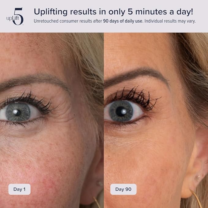 upLift 5 Anti-Aging Device | Prevent Long-Term Facial Decline