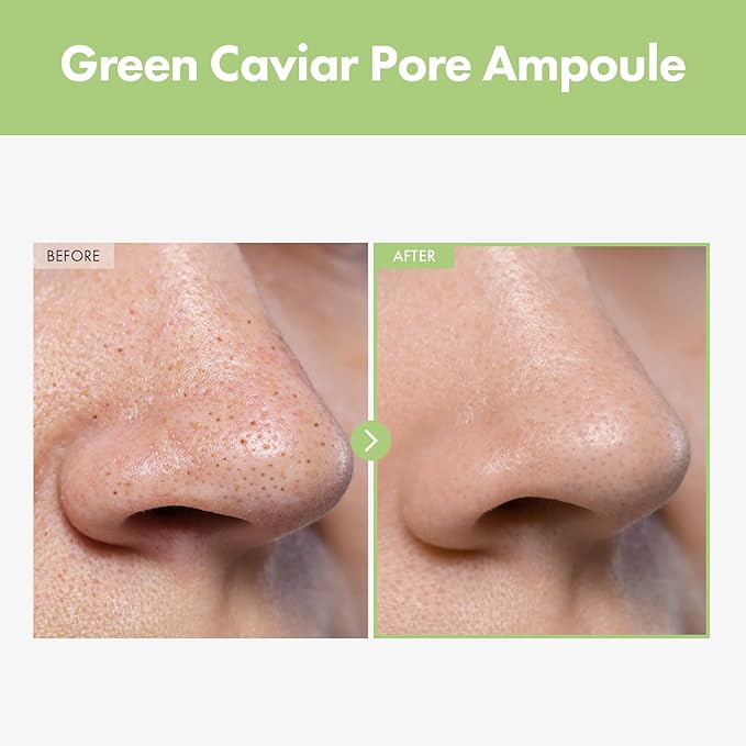 TOSOWOONG Green Caviar Pore Ampoule for Pore Care, Firming, Hydrating