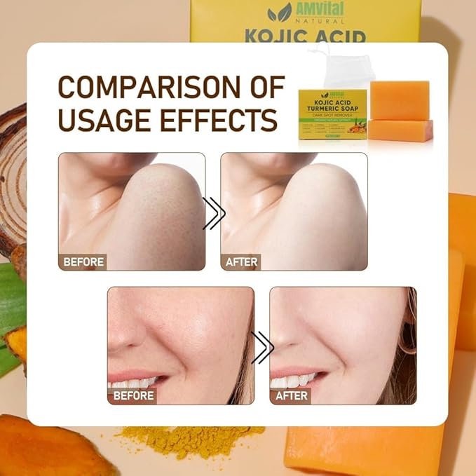 AMVital Turmeric Kojic Acid Soap Bars for Face & Body, 4-Pack