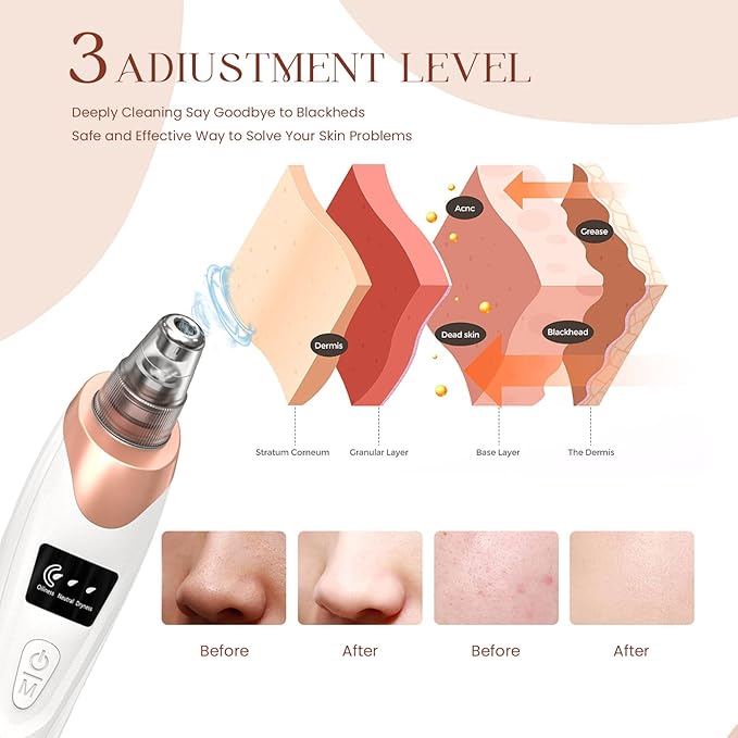 2026 Blackhead Remover Pore Vacuum,Facial Pore Cleaner-5 Suction Power,5 Probes,USB Rechargeable Blackhead Vacuum Kit Electric Pore Vacuum Tool for Adult