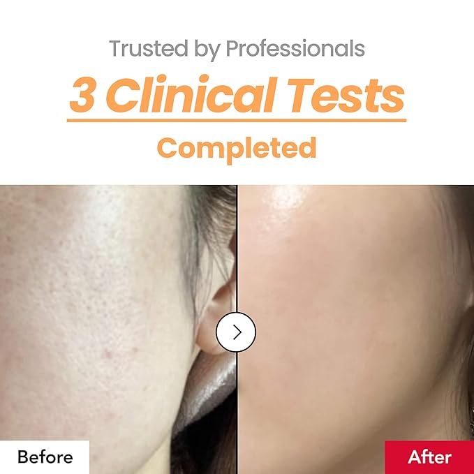 Dr.Percent Skin Texture Booster 214% Essence – Deep Hydration, Glass Skin, Triple Hyaluronic Acid, Collagen & Retinol, Lightweight & Non-Sticky, Visibly Plumping Effect, Korean Skincare, 5.07 fl oz