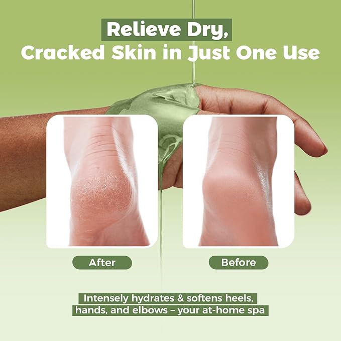 GIRLEARLE Paraffin Wax Refills 10 Packs for Paraffin Wax Bath Machine - for Dry Cracked Skin on Hands, Feet, Elbows - Moisturizing Hydration to Relieve Stiff Muscles & Joints (Aloe vera)