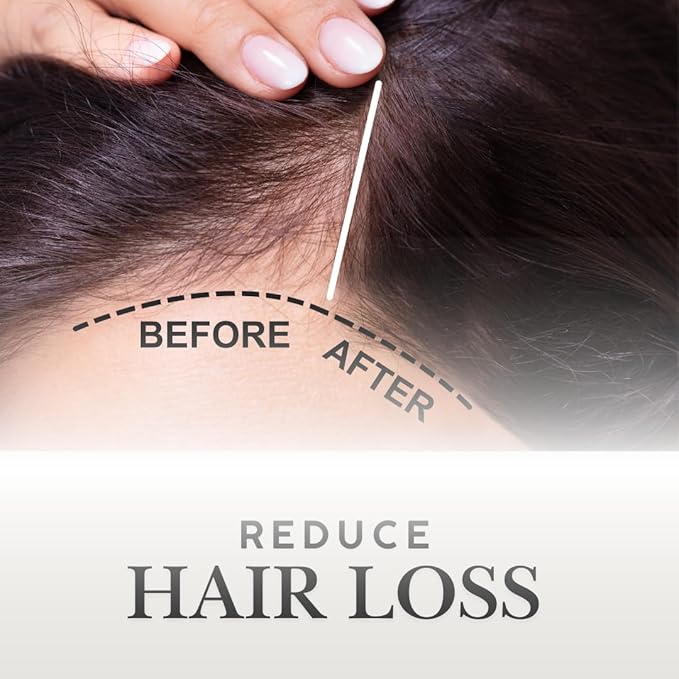 ORGANIC MODERN SOLUTION OMS Pre-Shampoo Hair Treatment Oil for Growth & Loss Prevention, Scalp Nourishing, Heat Protection, Anti-Frizz 3oz