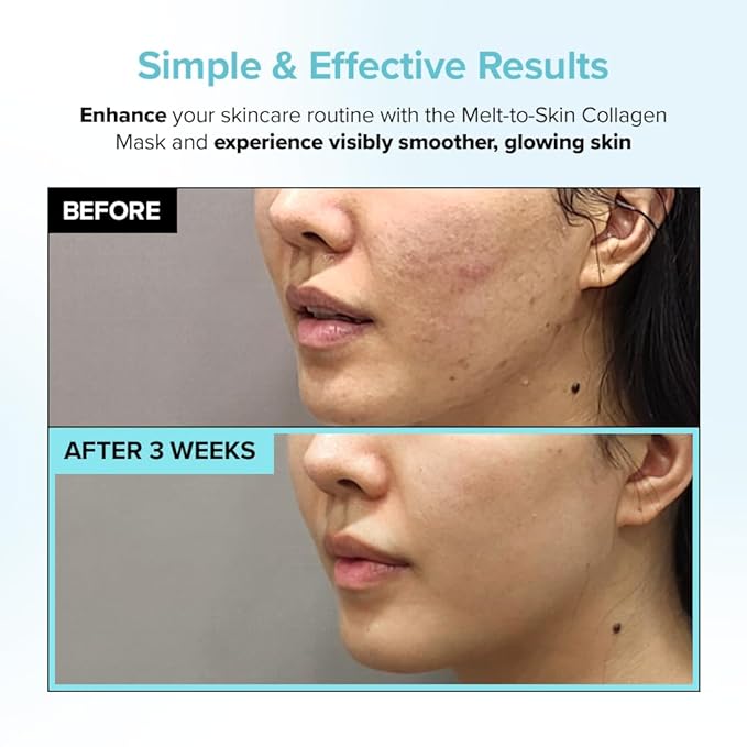 PAIGED Melt to Skin Collagen Mask, – Wrinkle Patches for Forehead, Eyes & Smile Lines - Frown Lines, Eleven-Lines Repair Patches, Invisible Face Wrinkles Smoothers - Korean Skin Care, 4EA