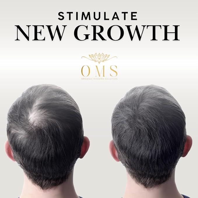 ORGANIC MODERN SOLUTION OMS Pre-Shampoo Hair Treatment Oil for Growth & Loss Prevention, Scalp Nourishing, Heat Protection, Anti-Frizz 3oz