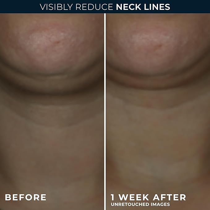 RoC Derm Correxion Neck Cream with Hyaluronic Acid + Advanced Retinol to visibly Tighten & Lift Horizontal Neck Lines, Facial Moisturizer to Contour Face (1.7 oz) with RoC Retinol Eye Packette