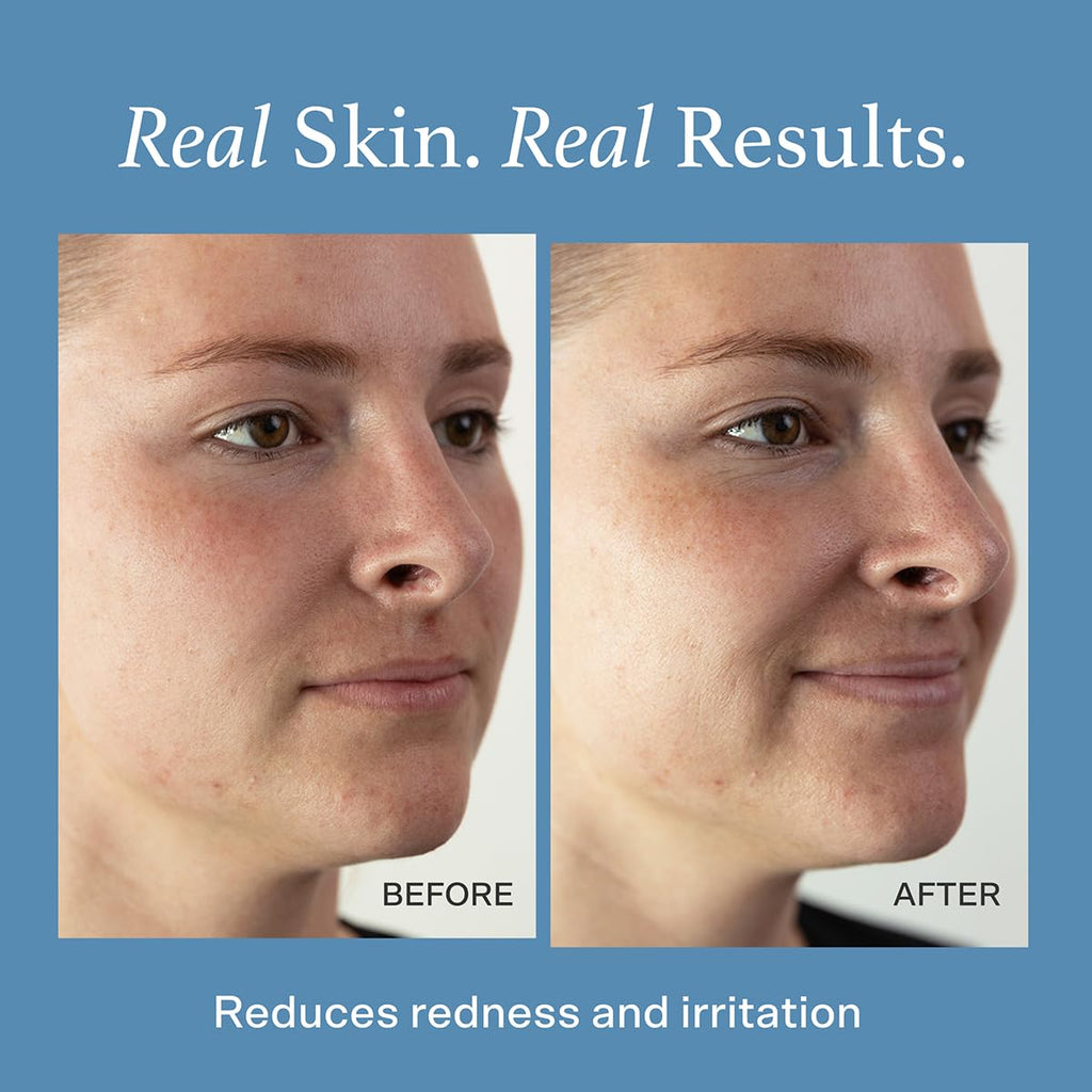 Otella Detox & Soothe Face Mist with Hypochlorous Acid.02% | 2.7 oz | Helps Reduce Redness, Irritation, Breakouts | Rosacea, Eczema, Sensitive-skin Safe | pH Balanced, Fragrance-Free, Fine Mist Toner