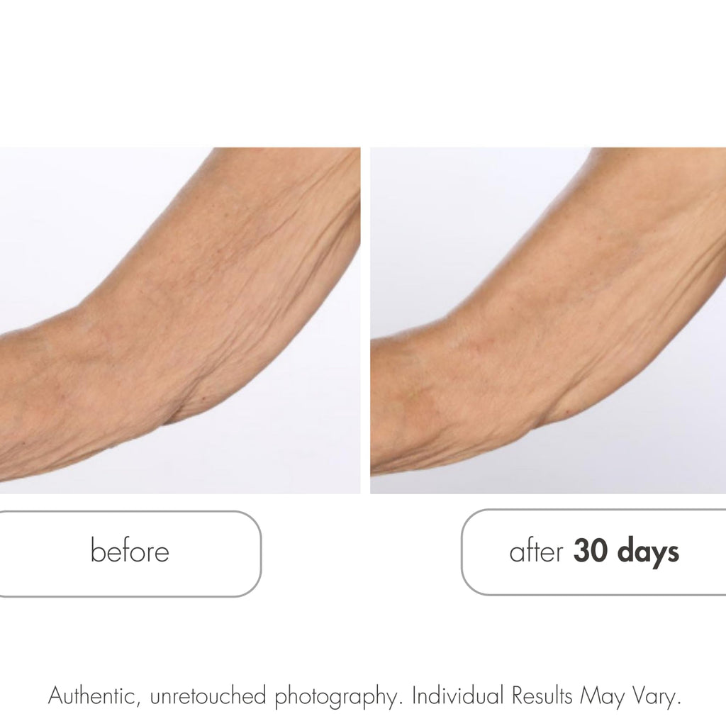 Serious Skincare Glycolic Retexturizing Toning Body Cream with BODY FIT™