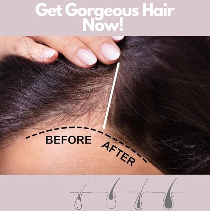 320Pure Hair Vitamin Booster Strengthening Spray for Women All Hair Types