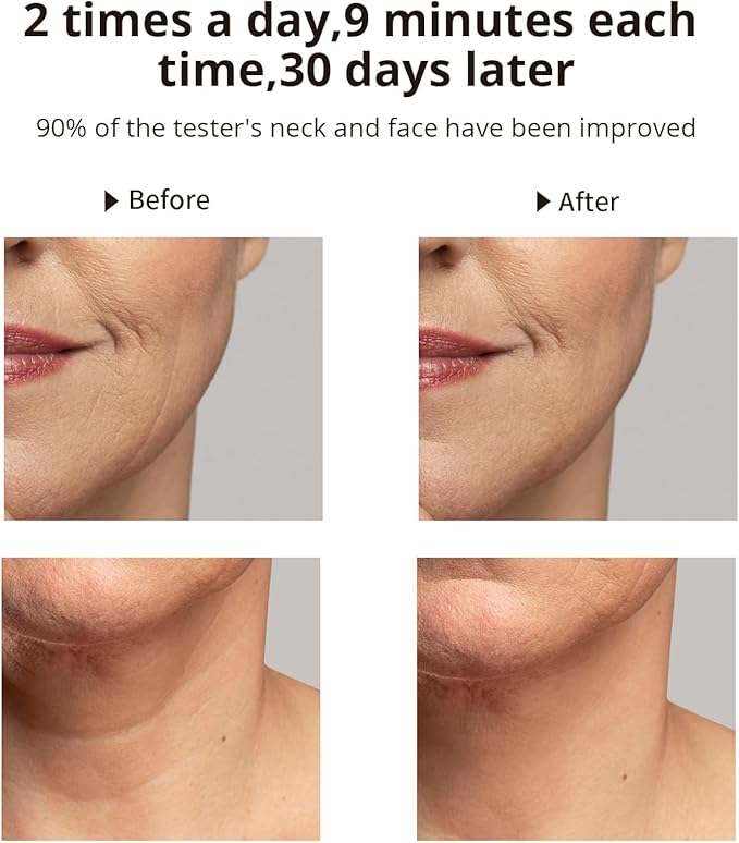 Facial Massager, Red Light Face Neck Device with Tightening & Rejuvenation