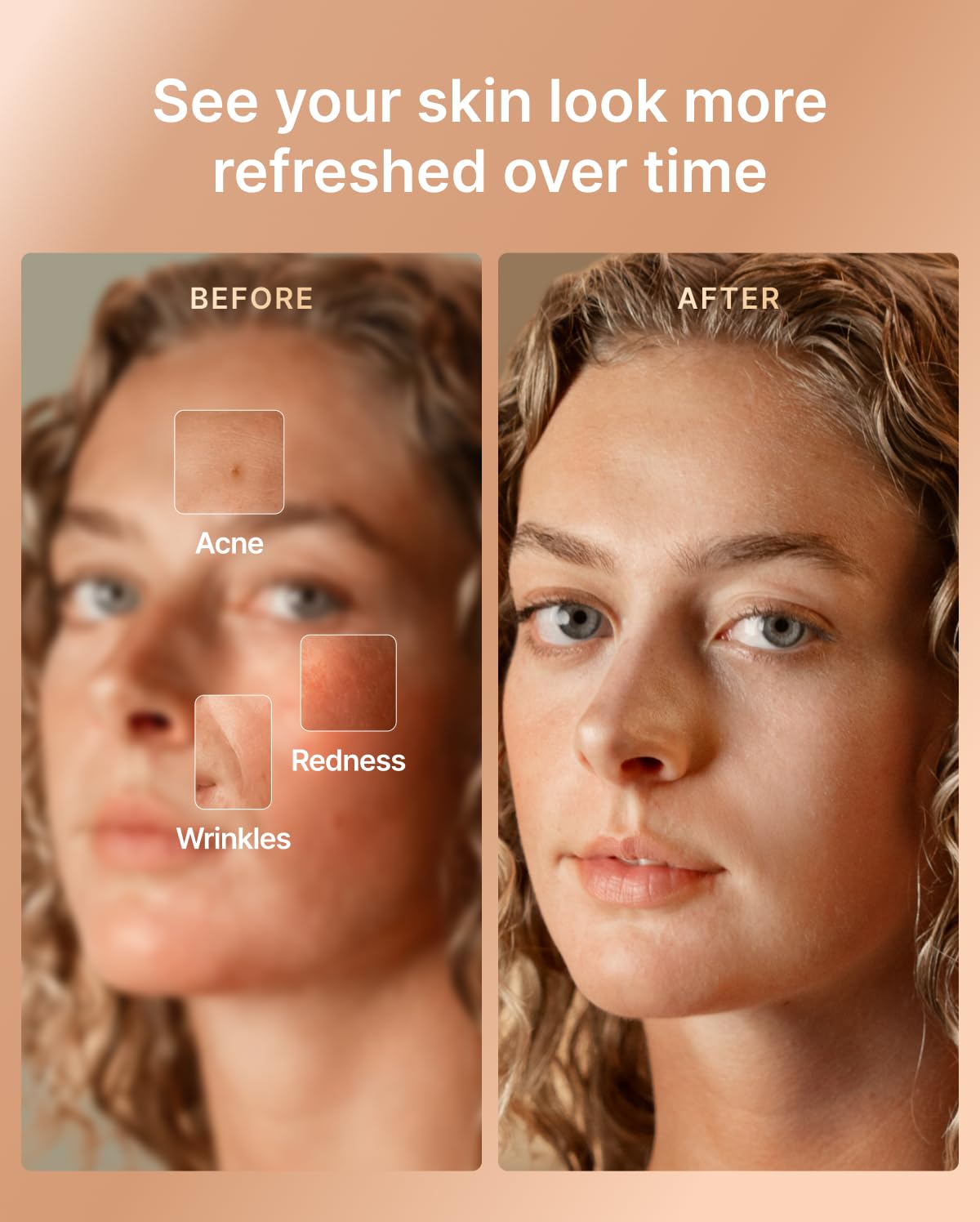 RENPHO Red Light Therapy Mask for Face, FDA-Cleared,Birthday Gifts for Wife