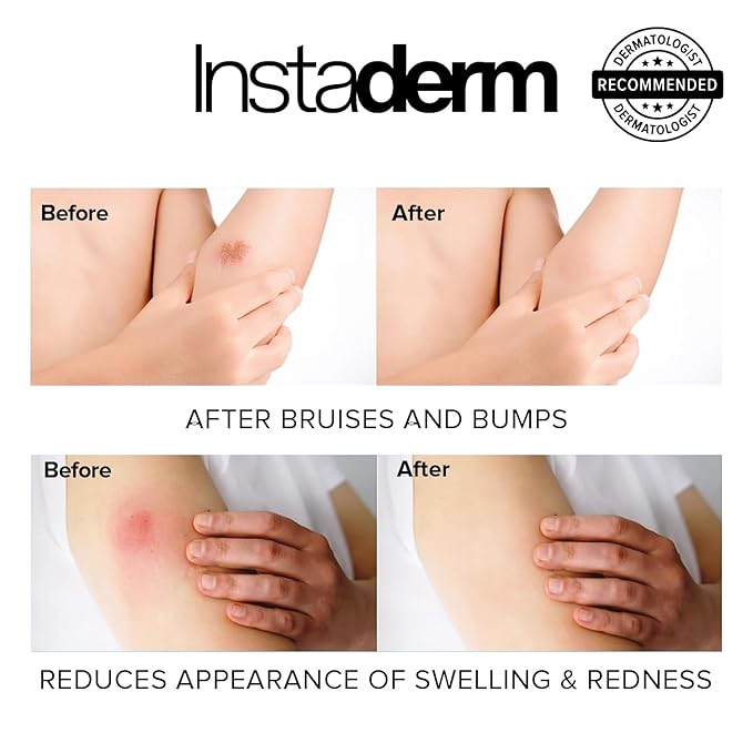 Vitamin K Cream-Revitalizing Formula with Arnica for the Appearance of Brusing, Spider Veins, Broken Capillaries, Uneven Tone & Dark Spot – Under Eye Cream for the Look of Dark Circles & Puffiness