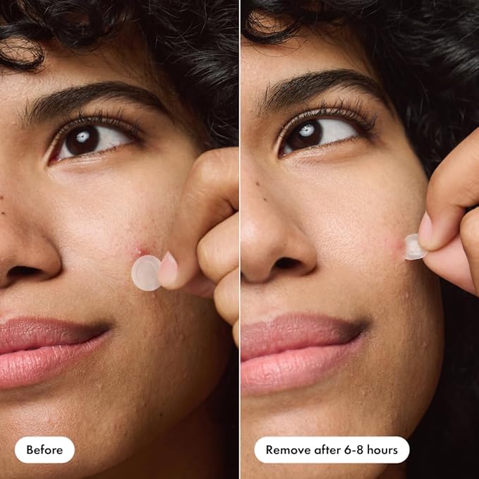 Hero Cosmetics Mighty Patch Invisible+ Daytime Acne Pimple Patch, 72 Ct