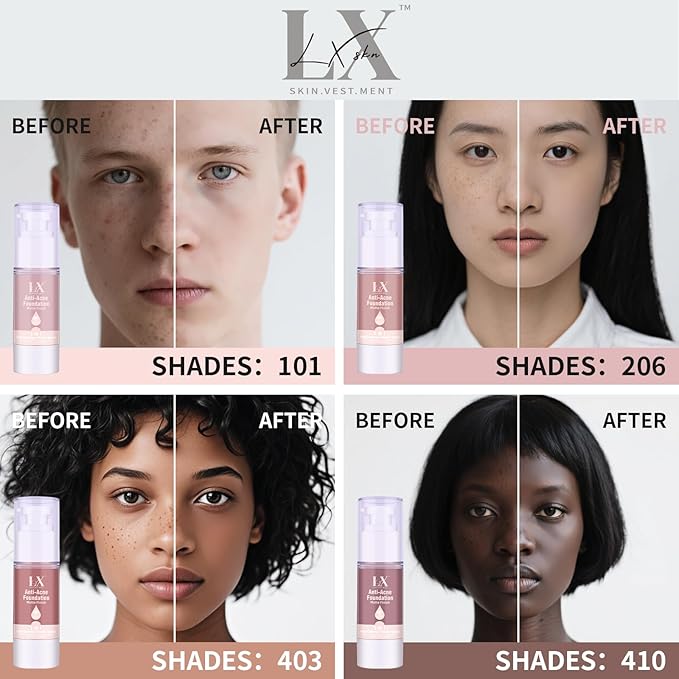 LXSKN Acne-serum Foundation with Salicylic Acid & Vitamin E, Sensitive Skin Foundation Vegan & Non-Comedogenic for Acne Skin Care (Medium-209)