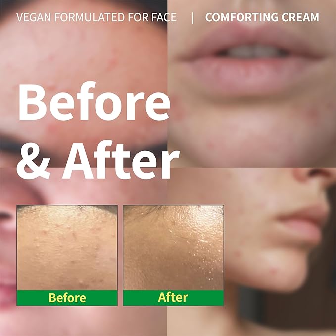 EARTHAT Barrier Repair Cream, Redness Relief for Sensitive Skin
