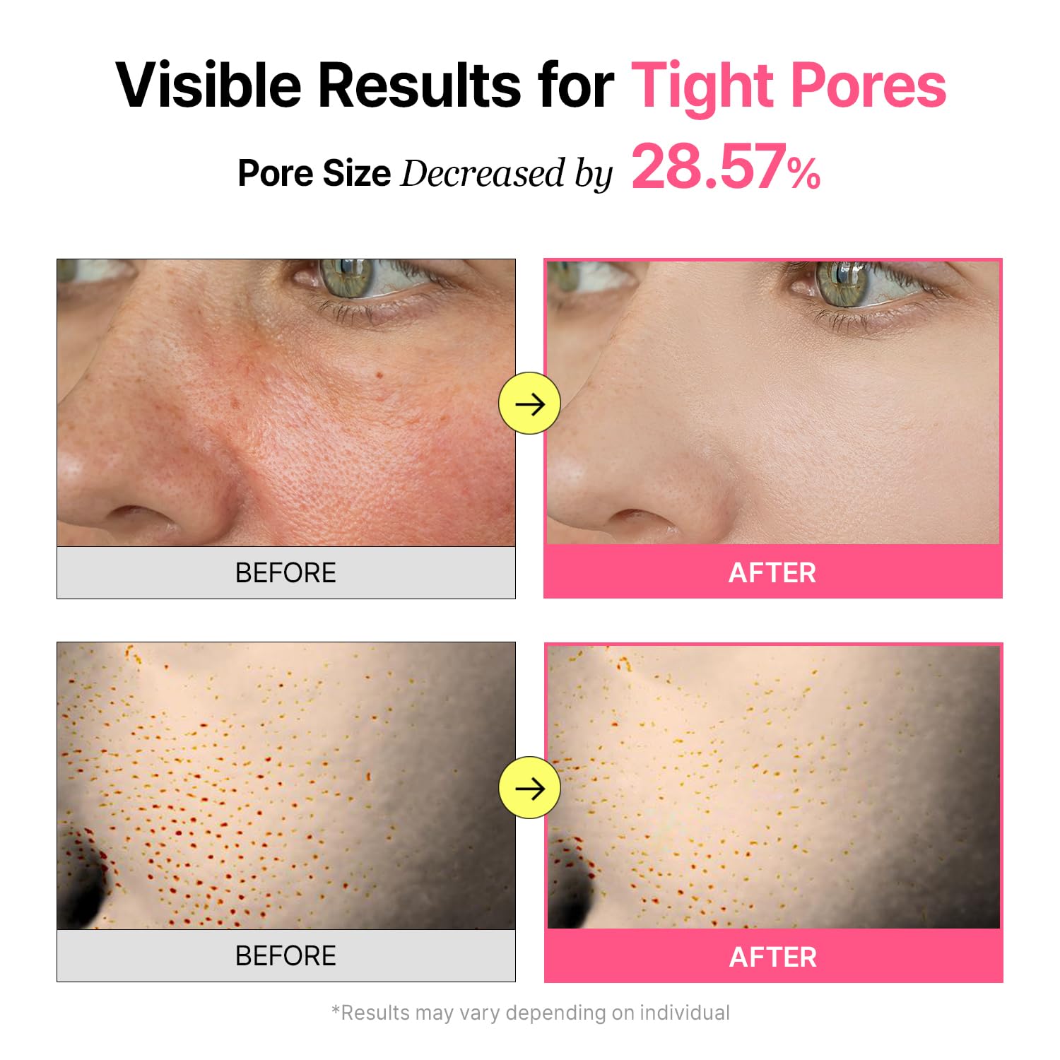 Veganifect Pore Refining Toner Pad for All Skin Types, Sebum Control, Tighten Pores, Korean Skin Care, Vegan (70 Pads)