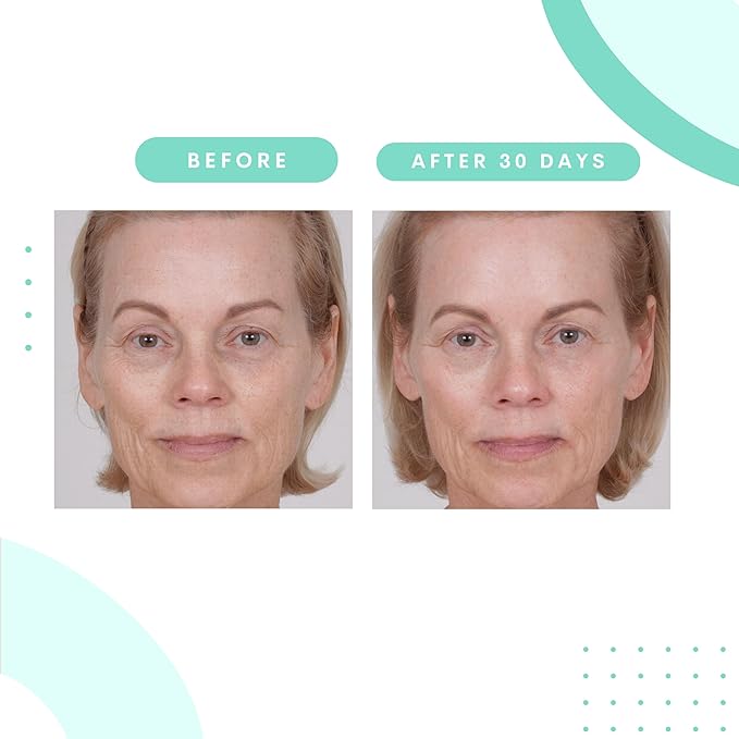 Serious Skincare Glycolic Acid Resurfacing Treatment Pads for Face, Exfoliates & Removes Dulling Dead Skin Cells, Unclogs Pores & Visibly Improves Skin Radiance & Texture, 60 Pre-Soaked Disc (2Pack)