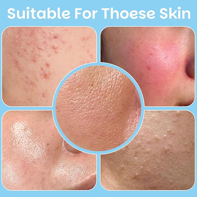 Kestper Salicylic Acid Exfoliating Facial Pads for Blemish-Prone Skin