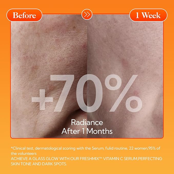 LANBENA Revolutionary Vitamin C Serum for Face, 1.05 Oz