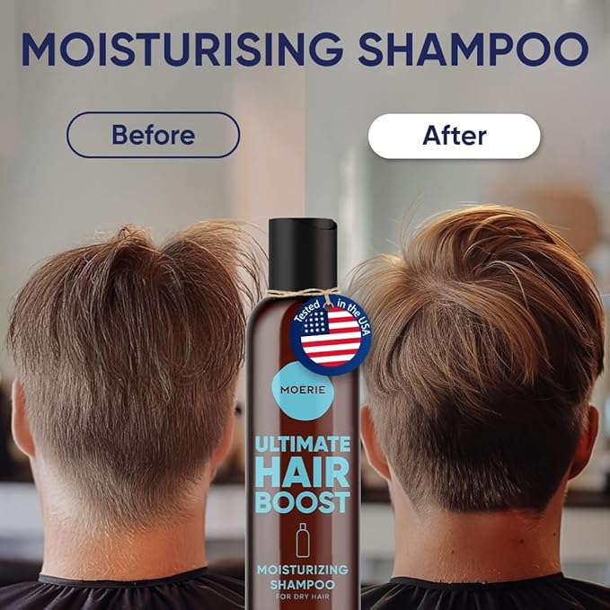 Moerie Hair Growth Shampoo for Men and Women, Hair Loss Solution with Biotin and Rosemary, Moisturizing Shampoo for Thinning Hair – Ultimate Boost for All Hair Types, Triple Set