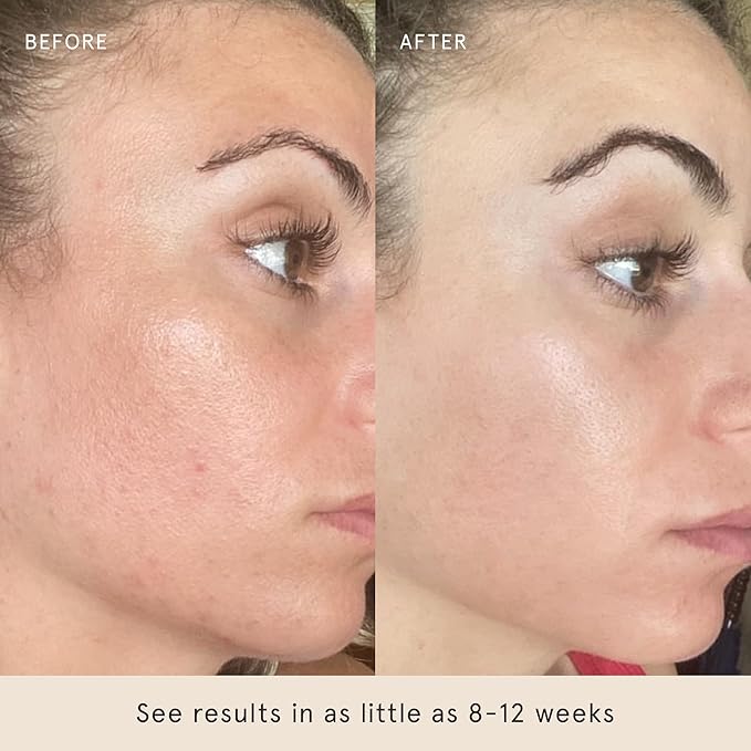 Barefaced Toning and Exfoliating Pads | Glycolic and Salicylic Acid Face Wipes for Blemishes, Dark Spots, and Uneven Texture | Daily Resurfacing Peels for Clear, Glowing Skin (60 Pads)