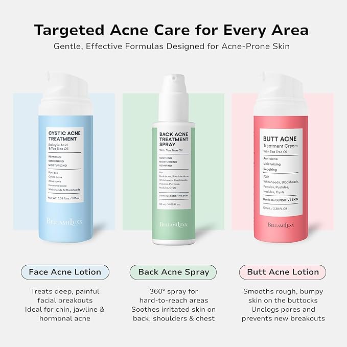 BellamiLuxx Fungal Acne Treatment Lotion: Effective Face & Body Pimple Cream for Bumps, Clusters, Itch & Redness – Fungal-Prone Skin Acne Treatment Moisturizer for Teens & Adults with Natural Actives