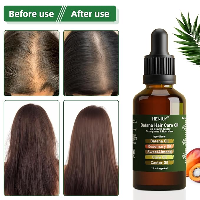HENIUY Battana Hair Care Oil – 2Fl Oz Natural Rosemary & Sweet Almond Oil Blend for Hair Growth & Repair – Organic, Vegan, Cruelty-Free – Lightweight, Non-Greasy Formula for Women & Men