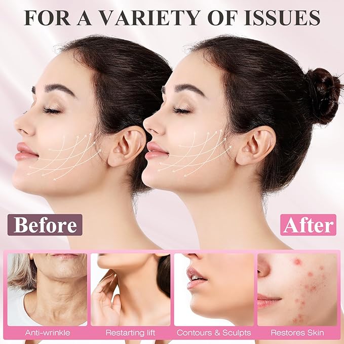 Juskaa Chin Strap for Sleeping,V Line Lifting Mask,Pink,M