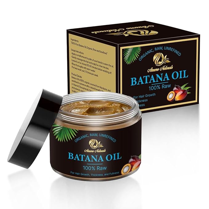 Anume Naturals 100% Pure Raw Batana Oil for Hair Growth – Organic & Unrefined Hair Oil for Dry, Frizzy & Curly Hair | Vitamin E-Rich Scalp & Hair Moisturizer | 4 oz