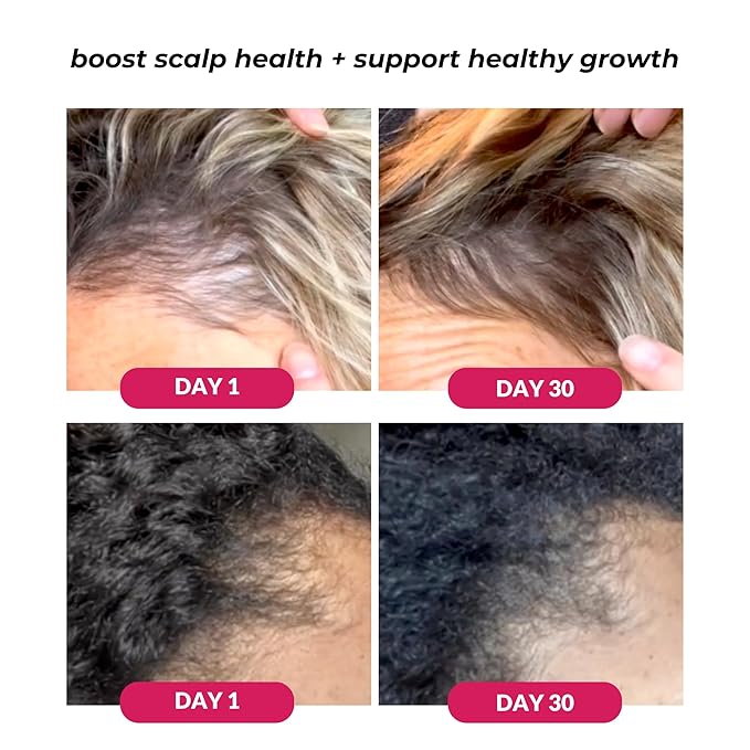 Love Ur Curls Healthy Scalp Serum - Moisturizing for Thicker Fuller Hair