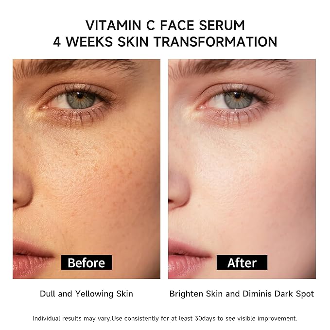 BACHERI Vitamin C Face Serum with Glutathione, 4D Hyaluronic Acid & Aloe Vera – Lightweight Brightening & Hydrating Ampoule for Daily Skincare, Dark Spots, Sensitive Skin Friendly - (1.0 ml)*30 Vials