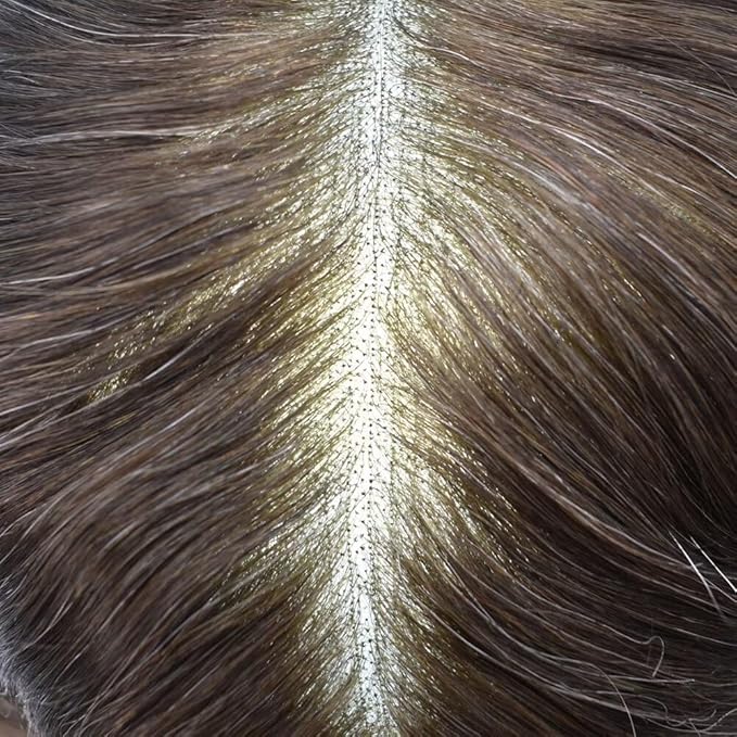 F M FACE MIRACLE NEW YORK Toupee for Men French Lace Center Mens Toupee Hairpiens Human Hair Replacement System Black Brown Blonde Gray Hair Units, 7X9