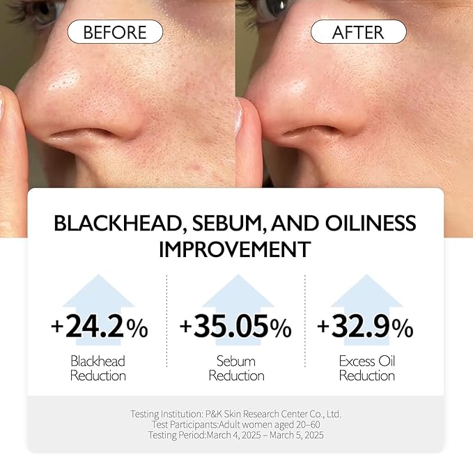 VIDIVICI Clear Pore Control Cleansing Oil 10.14 fl.oz | Makeup remover with blackhead care, Korean facial cleanser for oily skin, Sebum control with Bamboo Charcoal Powder, Korean skin care
