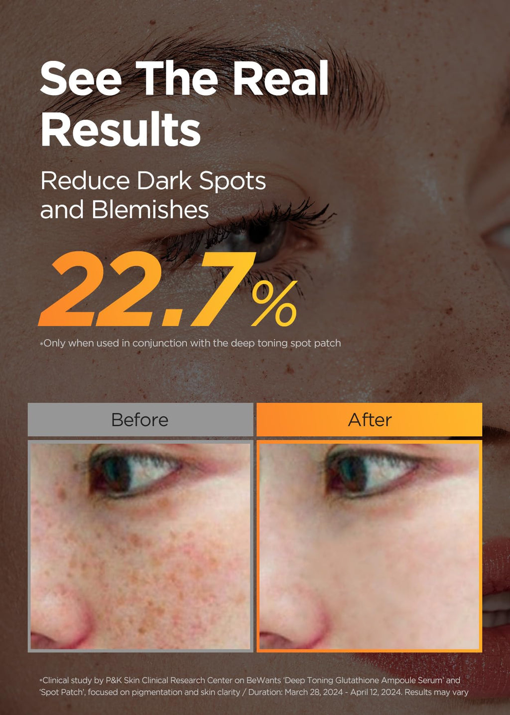 bewants Skin Brightening Glutathione Serum, Deep Toning Complex for Even Skin Tone, with Vitamin C, Niacinamide 50,000ppm, and Dark Spot care, 1.01 fl oz (1 Pack)