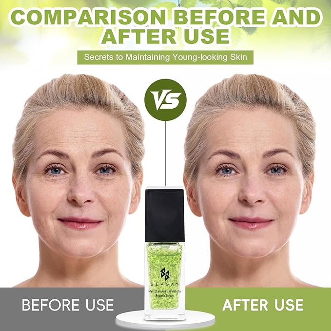 SEASAY Myrothamnus Flabellifolius Rebirth Serum - Premium Revitalizing Green key Essence for Anti-Aging & Repair Plant Extract (30ml)