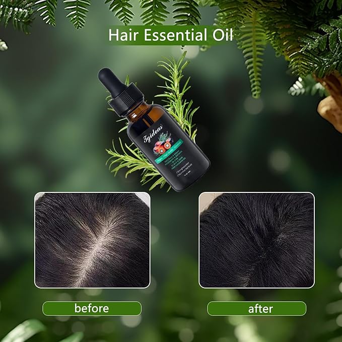 Tgideas Rosemary Batana Hair Oil for Scalp Care & Hair Strengthening 1 Pack
