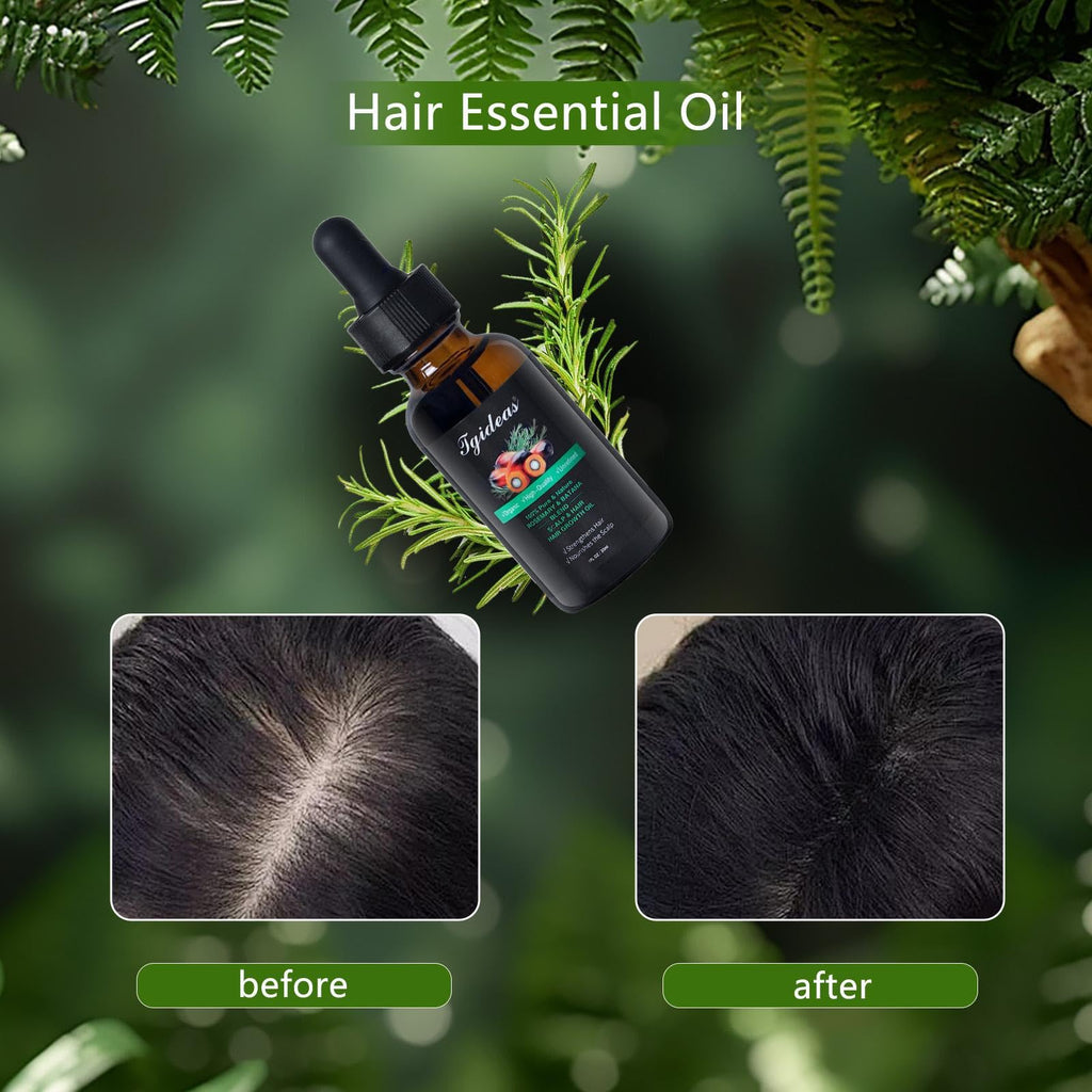 Tgideas Rosemary Batana Hair Oil for Scalp Care & Hair Strengthening 1 Pack