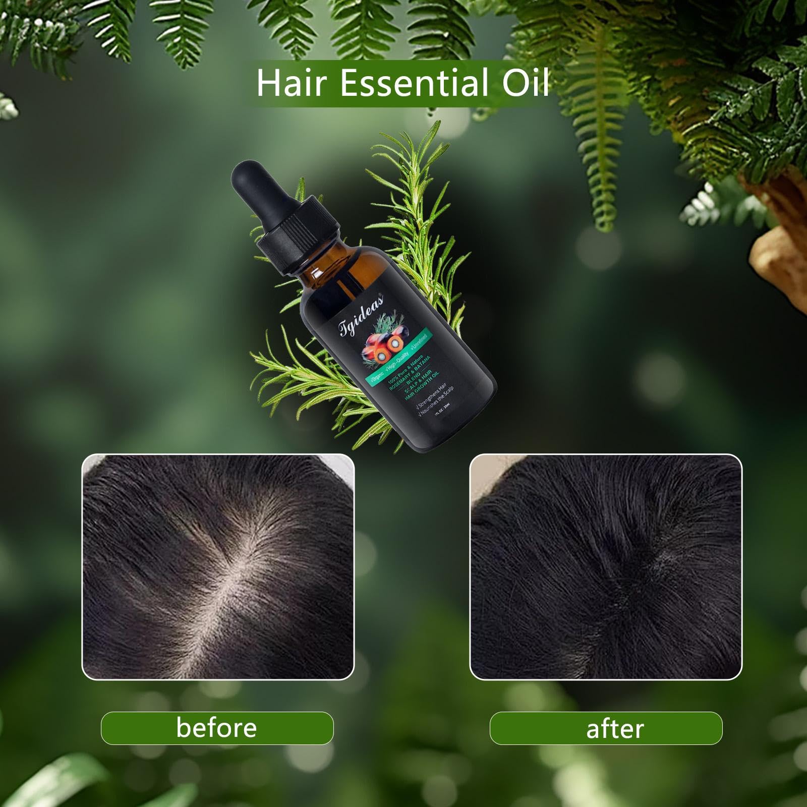 Tgideas Rosemary Batana Hair Oil for Scalp Care & Hair Strengthening 1 Pack