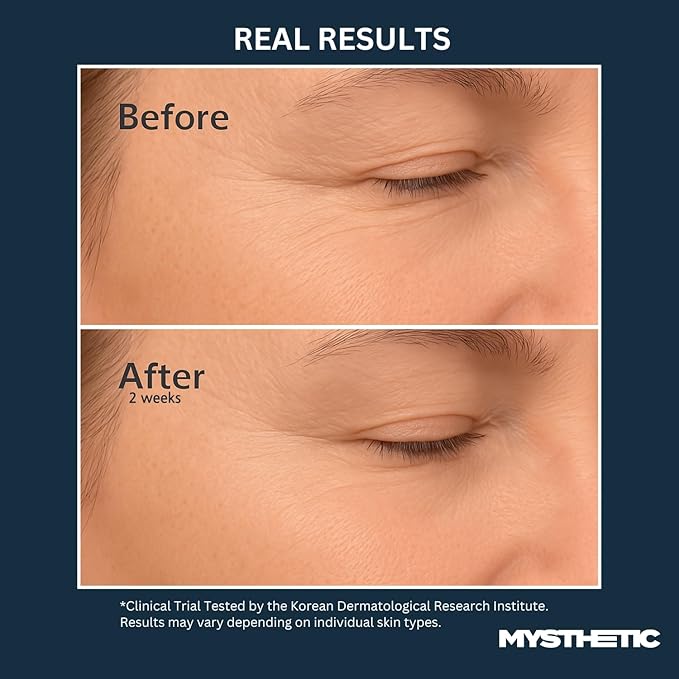 MYSTHETIC PDRN Collagen Wrapping Mask with CICA-PDRN Micro-Spicule Shots for Elasticity, Pore-Minimizing, Hydration, Glow - Korean Skin Care - 2.7 FL. OZ.