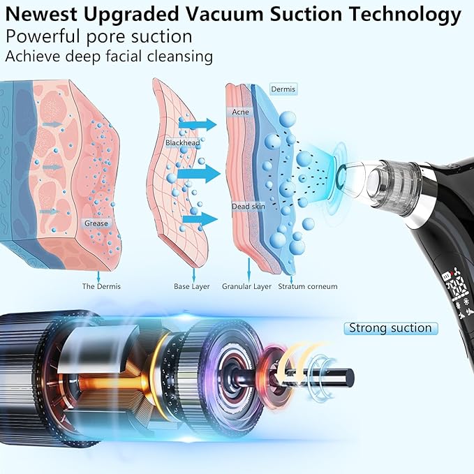 SJIE Blackhead Remover Vacuum Face Suction Pore Cleaner with Hot&Cold Compress Positive&Negative Ion Massage Nose Whitehead Remover Pimple Sucker with 5 Probes Pore Extractor Tool… (Black)